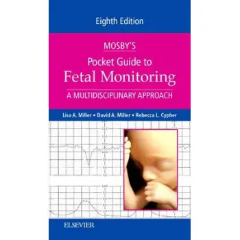 MOSBY'S POCKET GUIDE TO FETAL MONITORING  PB MOSBY'S POCKET GUIDE TO FETAL MONITORING  PB