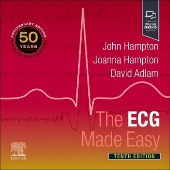 THE ECG MADE EASY PB