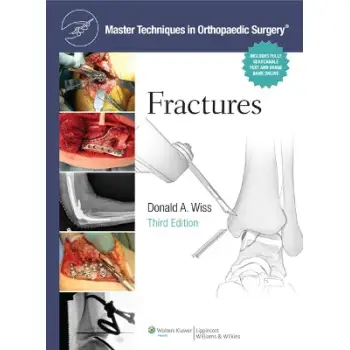 MTOS : FRACTURES 3E CB