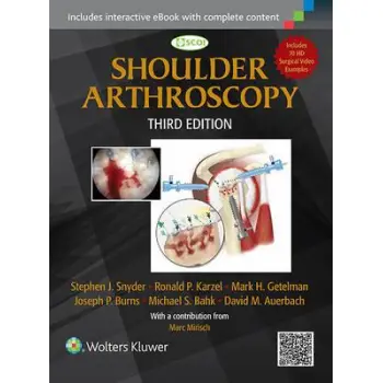 SHOULDER ARTHROSCOPY HC