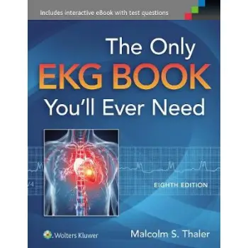 THE ONLY EKG BOOK YOU'LL EVER NEED PB