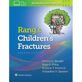 RANGS CHILDRENS FRACTURES