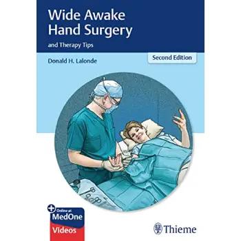 WIDE AWAKE HAND SURGERY AND THERAPY TIPS