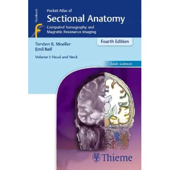 Pocket Atlas of Sectional Anatomy, Volume I: Head and Neck : Computed Tomography and Magnetic Resona