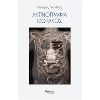 ΑΚΤΙΝΟΓΡΑΦΙΑ ΘΩΡΑΚΟΣ