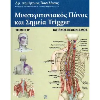 ΜΥΟΠΕΡΙΤΟΝΙΑΚΟΣ ΠΟΝΟΣ ΚΑΙ ΣΗΜΕΙΑ TRIGGER