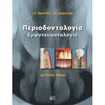 ΠΕΡΙΟΔΟΝΤΟΛΟΓΙΑ ΕΜΦΥΤΕΥΜΑΤΟΛΟΓΙΑ 2Η ΕΚΔΟΣΗ