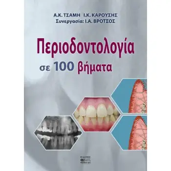 ΠΕΡΙΟΔΟΝΤΟΛΟΓΙΑ ΣΕ 100 ΒΗΜΑΤΑ