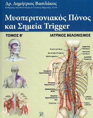 ΜΥΟΠΕΡΙΤΟΝΙΑΚΟΣ ΠΟΝΟΣ ΚΑΙ ΣΗΜΕΙΑ TRIGGER ΜΥΟΠΕΡΙΤΟΝΙΑΚΟΣ ΠΟΝΟΣ ΚΑΙ ΣΗΜΕΙΑ TRIGGER