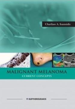 MALIGNANT MELANOMA CURRENT CONCEPTS MALIGNANT MELANOMA CURRENT CONCEPTS